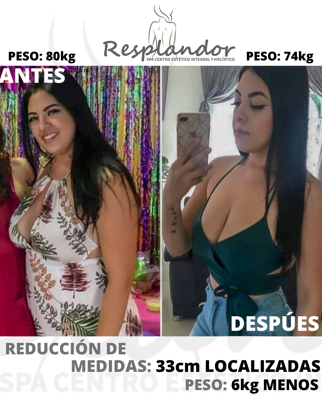 REDUCCIÓN DE MEDIDAS (11)