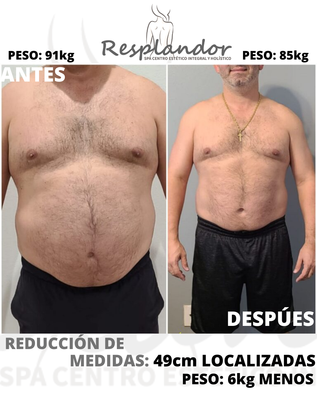 REDUCCIÓN DE MEDIDAS (13)