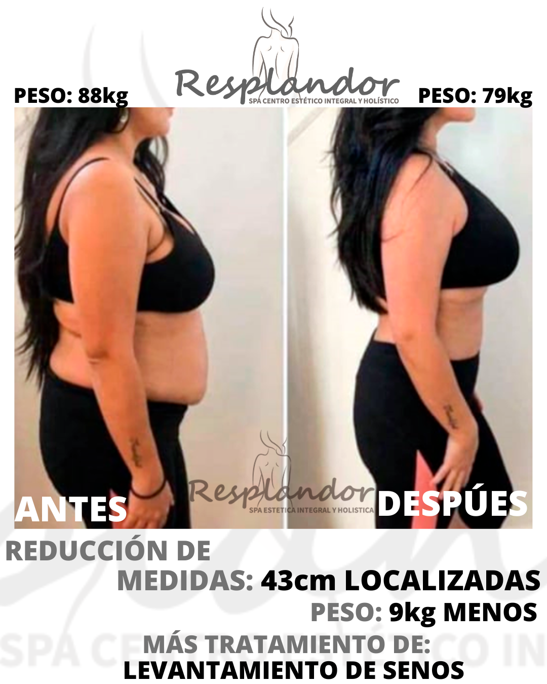 REDUCCIÓN DE MEDIDAS (8)