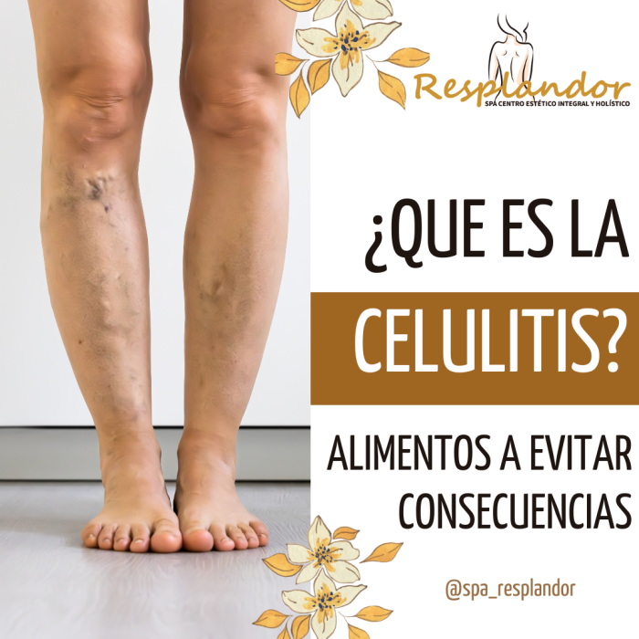 CELULITIS